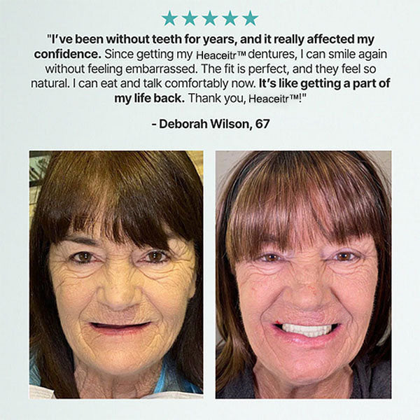 đEnds Today: 70% OFF! â°Custom-Fit Dentures â Designed for Comfort and a Natural-Looking Smile