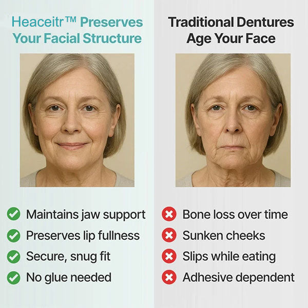 🌎Ends Today: 70% OFF! ⏰Custom-Fit Dentures — Designed for Comfort and a Natural-Looking Smile