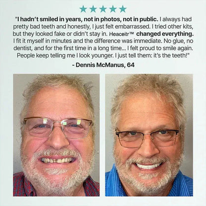 🌎Ends Today: 70% OFF! ⏰Custom-Fit Dentures — Designed for Comfort and a Natural-Looking Smile