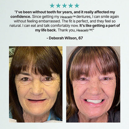 🌎Ends Today: 70% OFF! ⏰Custom-Fit Dentures — Designed for Comfort and a Natural-Looking Smile